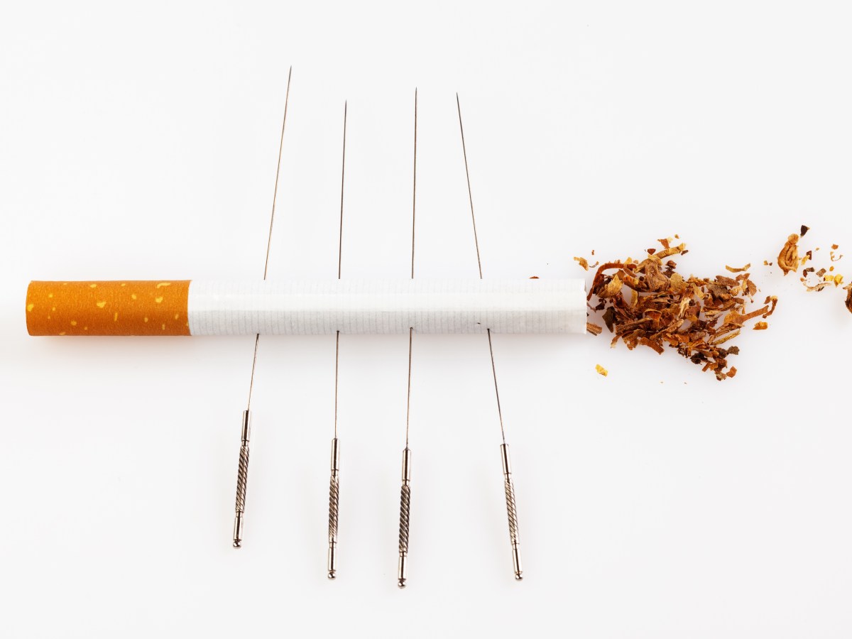 Three ways to help you stop smoking with&nbsp;acupuncture
