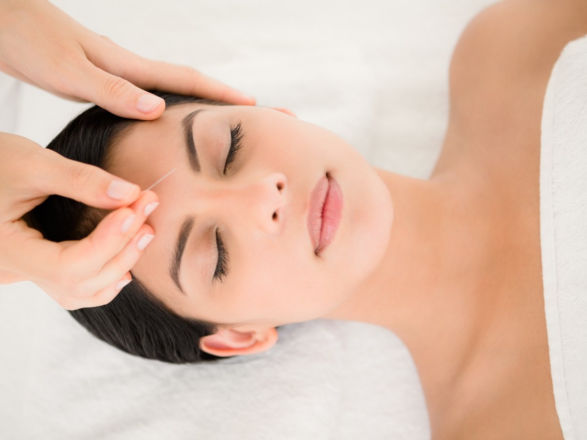 Why try acupuncture?